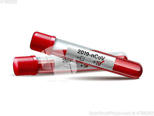 Image of Test tube with blood sample for COVID-19, Coronavirus test.