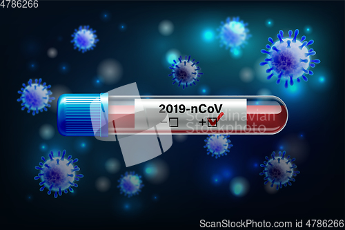 Image of Test tube with blood sample for COVID-19, Coronavirus test.