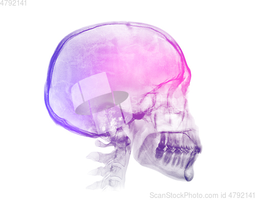 Image of Human skull X-ray image