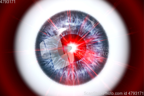 Image of eye ball iris with laser light