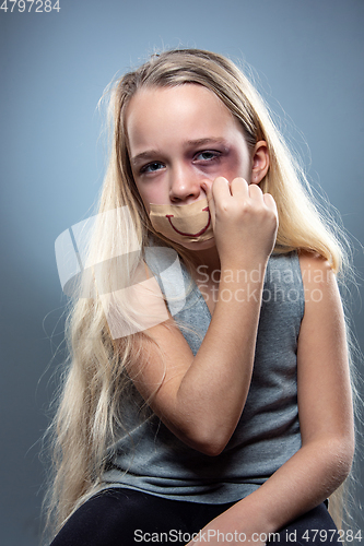 Image of Sad and frightened little girl with bloodshot and bruised eyes, fiction of happiness