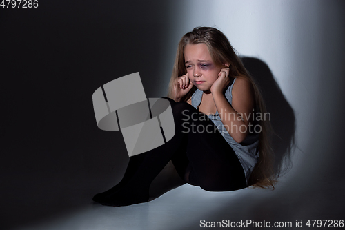 Image of Sad and frightened little girl with bloodshot and bruised eyes sitting scared