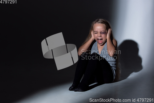 Image of Sad and frightened little girl with bloodshot and bruised eyes sitting scared