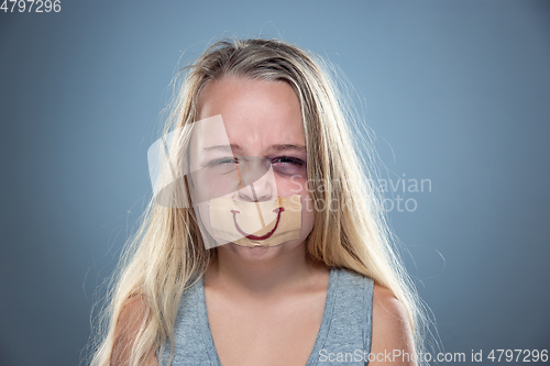 Image of Sad and frightened little girl with bloodshot and bruised eyes, fiction of happiness