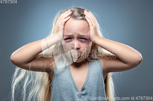 Image of Sad and frightened little girl with bloodshot and bruised eyes, fiction of happiness