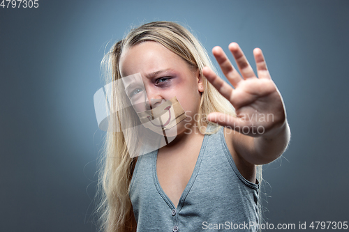 Image of Sad and frightened little girl with bloodshot and bruised eyes, fiction of happiness