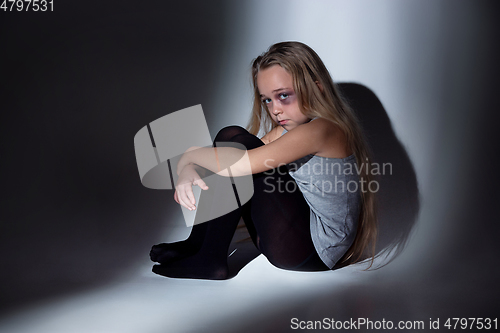 Image of Sad and frightened little girl with bloodshot and bruised eyes sitting scared