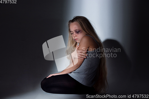 Image of Sad and frightened little girl with bloodshot and bruised eyes sitting scared