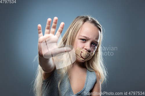 Image of Sad and frightened little girl with bloodshot and bruised eyes, fiction of happiness