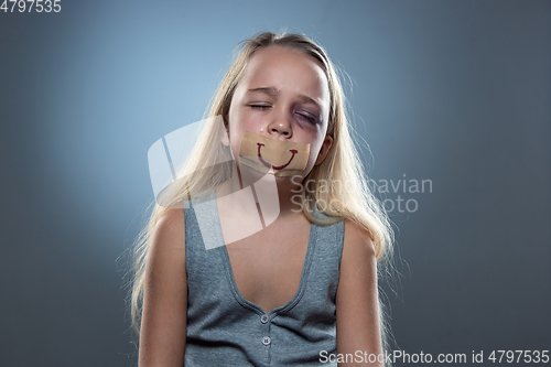 Image of Sad and frightened little girl with bloodshot and bruised eyes, fiction of happiness