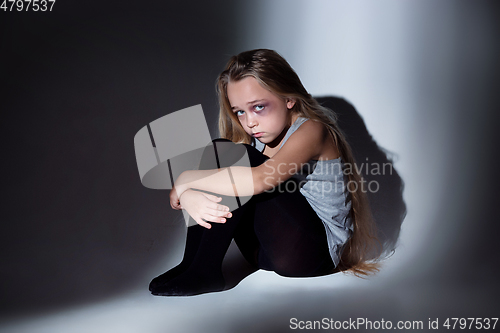 Image of Sad and frightened little girl with bloodshot and bruised eyes sitting scared