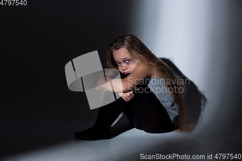 Image of Sad and frightened little girl with bloodshot and bruised eyes sitting scared