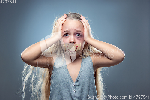 Image of Sad and frightened little girl with bloodshot and bruised eyes, fiction of happiness