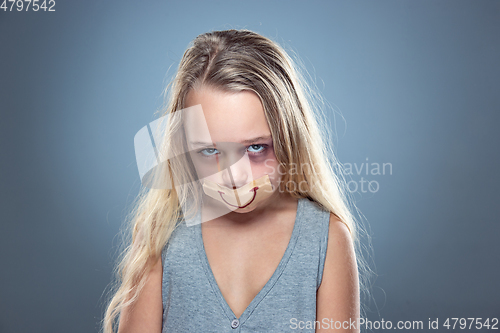 Image of Sad and frightened little girl with bloodshot and bruised eyes, fiction of happiness