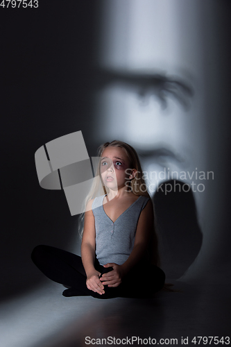 Image of Sad and frightened little girl with bloodshot and bruised eyes sitting scared