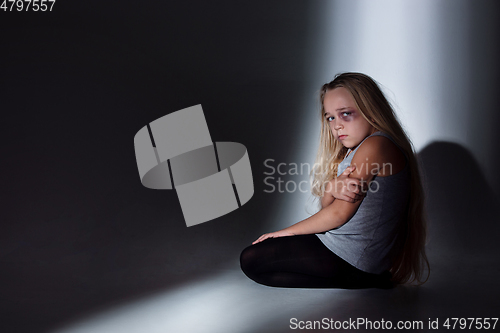 Image of Sad and frightened little girl with bloodshot and bruised eyes sitting scared