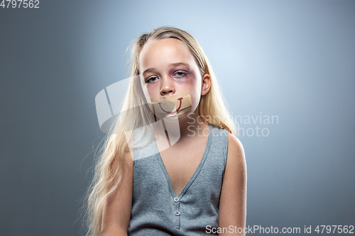 Image of Sad and frightened little girl with bloodshot and bruised eyes, fiction of happiness