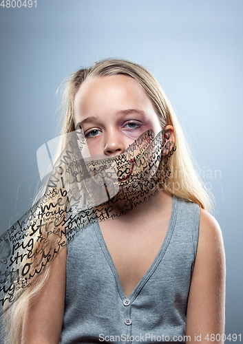 Image of Sad and frightened little girl with bloodshot and bruised eyes, fiction of happiness