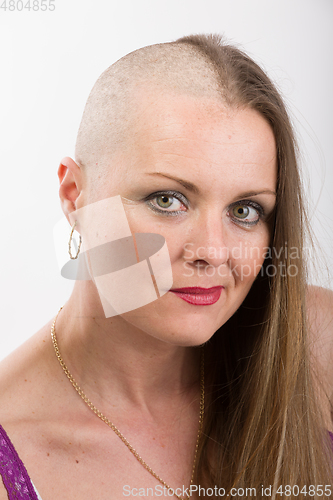 Image of beautiful woman cancer patient