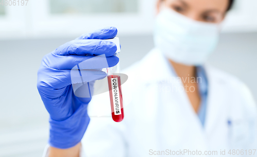 Image of scientist holding test tube with coronavirus