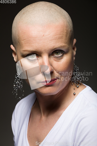 Image of beautiful woman cancer patient without hair