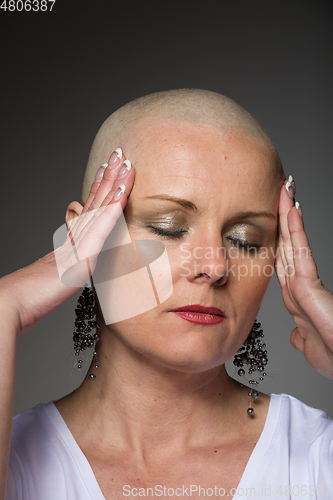 Image of beautiful woman cancer patient without hair