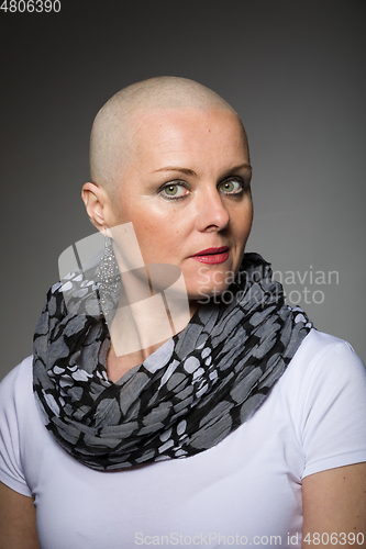 Image of beautiful woman cancer patient without hair