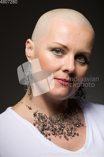 Image of beautiful woman cancer patient without hair