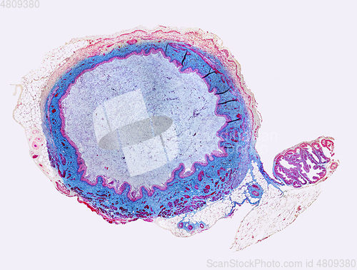 Image of Urinary bladder micrograph