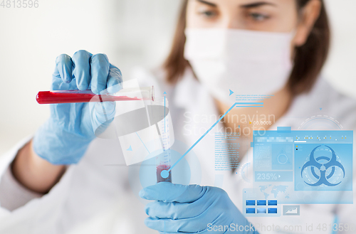 Image of close up of scientist making blood test in lab