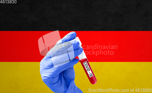 Image of hand with blood sample in test tube of coronavirus