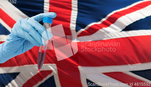 Image of hand holding test tube with coronavirus blood test
