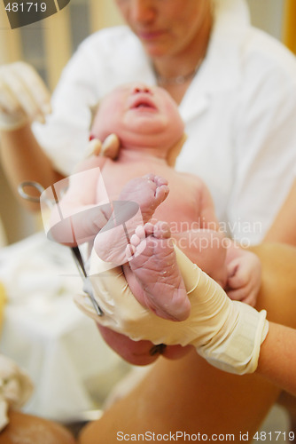 Image of A neonate