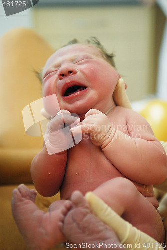 Image of A neonate