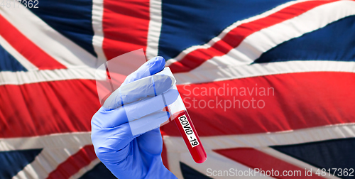 Image of hand with blood sample in test tube of coronavirus