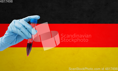 Image of hand holding test tube with coronavirus blood test