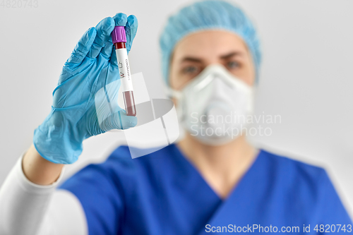 Image of doctor holding beaker with coronavirus blood test