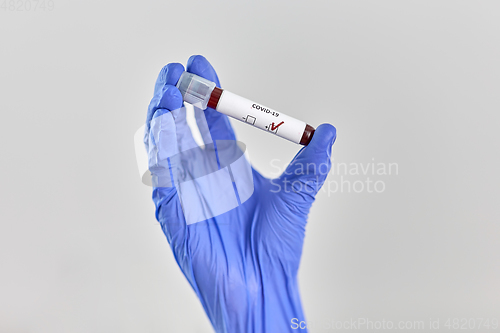 Image of hand holding beaker with coronavirus blood test