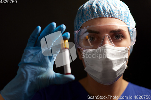 Image of close up of doctor holding beaker with blood test