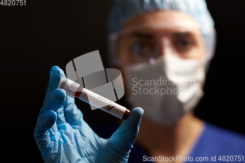 Image of doctor holding beaker with coronavirus blood test
