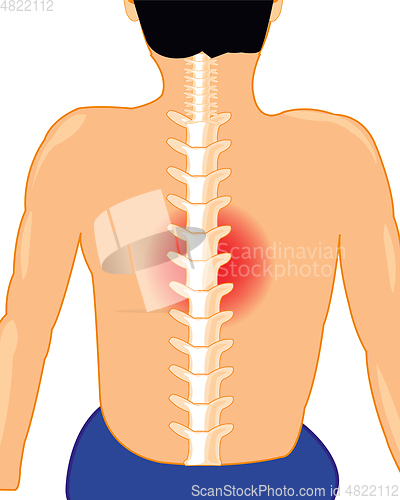 Image of Man with sick spine on white background is insulated