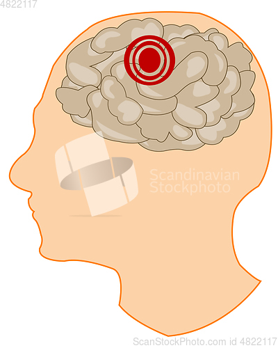 Image of Head of the person with sick brain