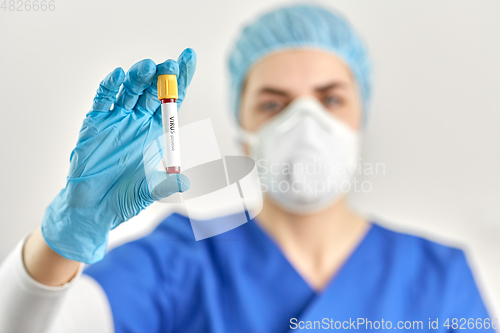 Image of doctor holding beaker with virus blood test