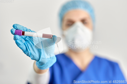 Image of close up of doctor holding beaker with blood test