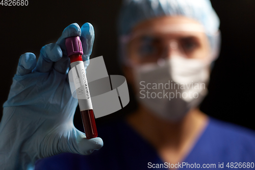 Image of doctor holding beaker with coronavirus blood test