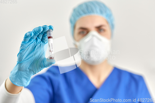 Image of doctor holding beaker with coronavirus blood test