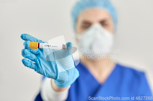 Image of doctor holding beaker with virus blood test