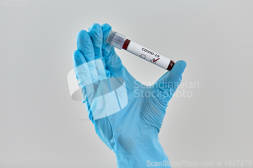 Image of hand holding beaker with coronavirus blood test