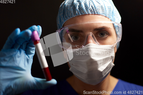 Image of close up of doctor holding beaker with blood test