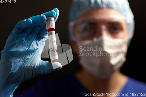 Image of doctor holding beaker with coronavirus blood test